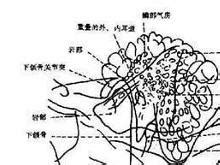 乳突炎的症状图片
