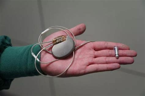 绵阳市中心医院专家完成世界最小无导线起搏器植入-医院汇-丁香园