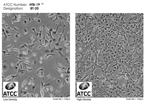 BT-20细胞ATCC HTB-19细胞 BT20人乳腺癌细胞株购买价格、培养基、培养条件、细胞图片、特征等基本信息_生物风