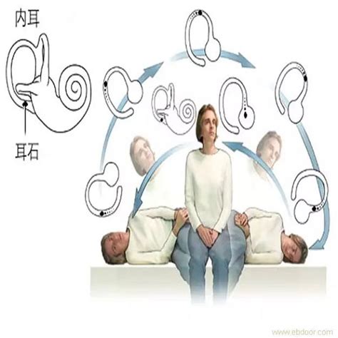 耳石症图片