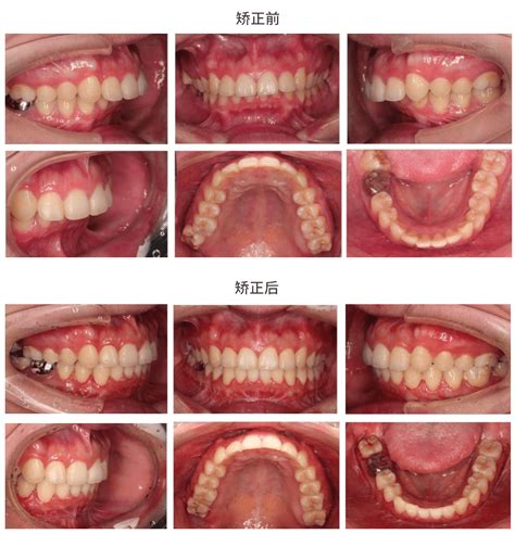 人体牙齿刷牙示范模型 自然大护理牙模型 牙齿 早教 1：1口腔模型-阿里巴巴