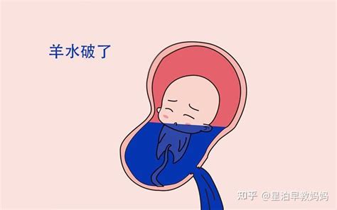 孕妇羊水破了，去医院的过程要注意些什么？ - 知乎