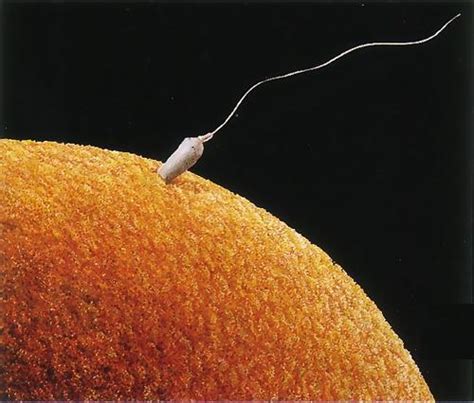 人工授精对卵子概念高清图片下载-正版图片402375213-摄图网