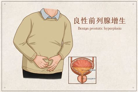 前列腺大小与年龄，是什么关系？