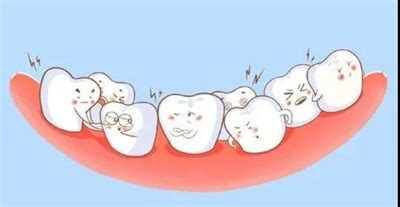 牙齿松动真的是因为缺钙吗？医生教您这样做！_东莞口腔医院