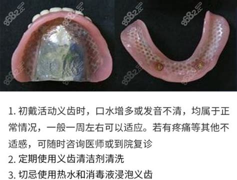 北京老人做满口假牙多少钱?树脂/钢托/钛托价格及区别奉上,牙齿修复-8682赴韩整形网