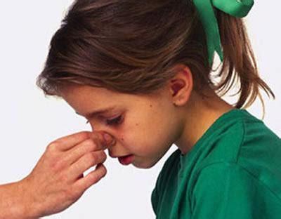小孩子流鼻血应该如何正确的止血？学会这些有问题时也能得心应手