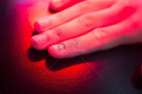 患者手在热光下进行红色理疗热处理高清图片下载-正版图片507545682-摄图网