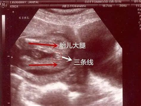 【胎心率】【图】如何判断宝宝性别 胎心率多少是男孩_伊秀亲子|yxlady.com