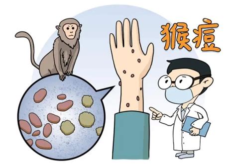 图解丨猴痘病例输入不用慌，四问四答带你认识它！