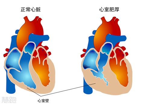 应用无创心输出量测定技术动态监测新生儿心力衰竭的心输出量及临床意义 - 中国小儿急救医学