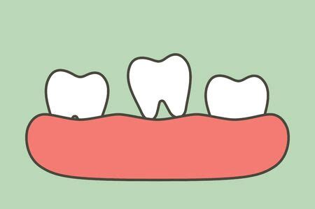 missing tooth - Illustrations et vecteurs libres de droits - Stocklib