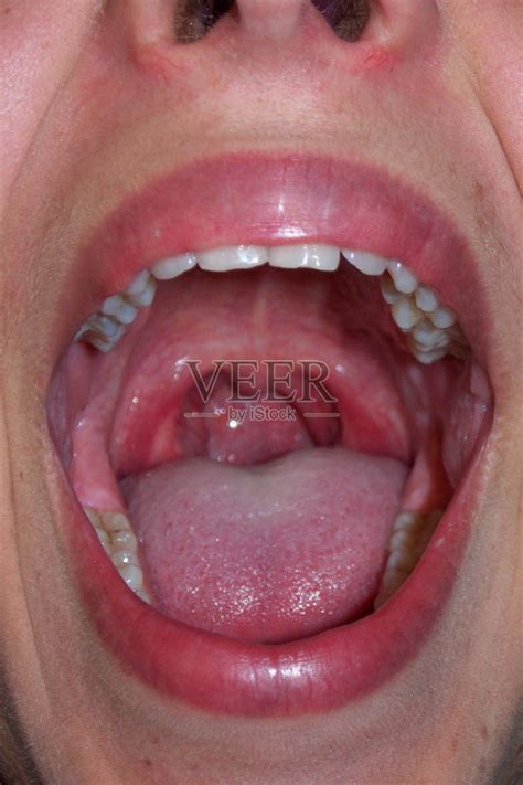 张着嘴,喉咙,舌头,垂直画幅,美正版图片素材下载_ID:144697246 - Veer图库