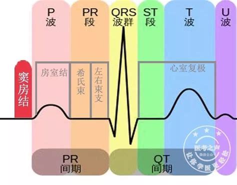 心电图连接示意图图片