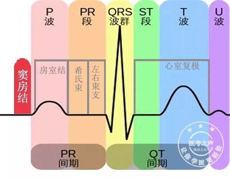 如何看懂心电图？ - 知乎