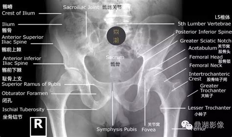 骨盆x线解剖图图片