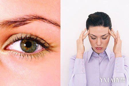 【图】眼睛疲劳缓解方法大全 这个办法简直绝了_眼睛疲劳缓解方法_伊秀健康网|yxlady.com