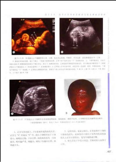 四肢短小的畸形婴儿图（一张图带你了解受精后胎宝的发育）-幼儿百科-魔术铺