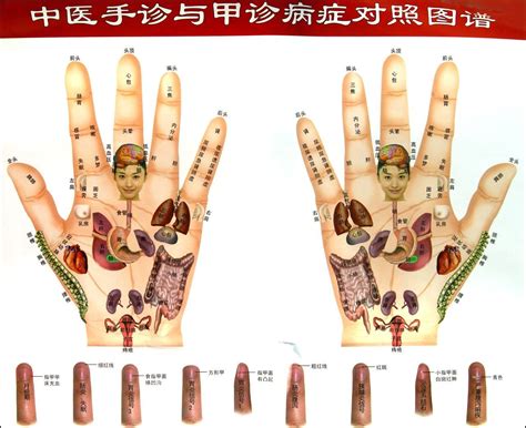 手诊图解看疾病图片