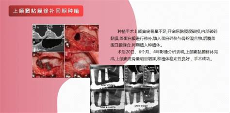 NK细胞通过监测生长因子PDGF-DD控制肿瘤生长-公司新闻-深圳市默赛尔生物医学科技发展有限公司