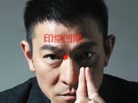女人印堂凹陷图片