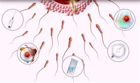 中华医学会 科普图文 促排卵方案有很多种，如何确定哪种更适合
