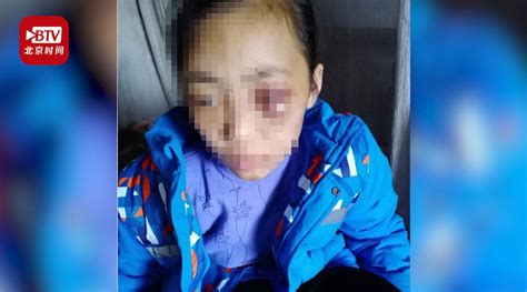 12岁女孩长期遭受继母家暴 全身多处受伤(含视频)_手机新浪网