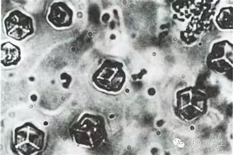 历史上的今天8月3日_1965年中国首次人工合成了牛胰岛素结晶。