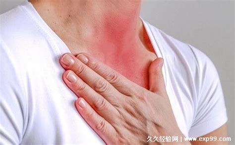 喉咙痒、嗓子痛？ 护嗓攻略-新闻中心-温州网