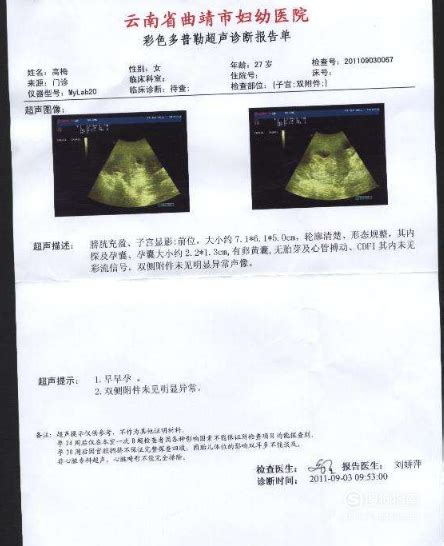 26周四维彩超胎儿检查报告单看看是否正常；可能分出男女 - 百度宝宝知道