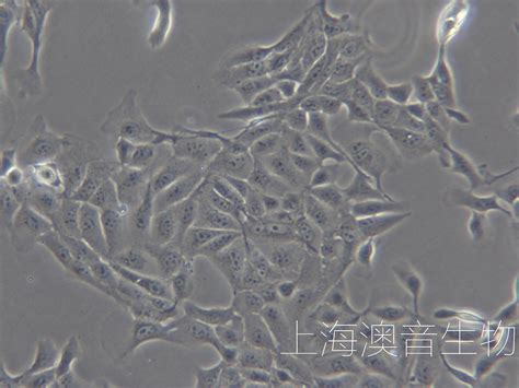 无血清悬浮培养型MDCK细胞株及其应用的制作方法