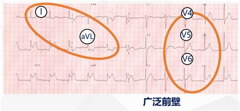 一位绝世老股民的心得：看懂V型底，悟透胜读十年书！ - 知乎