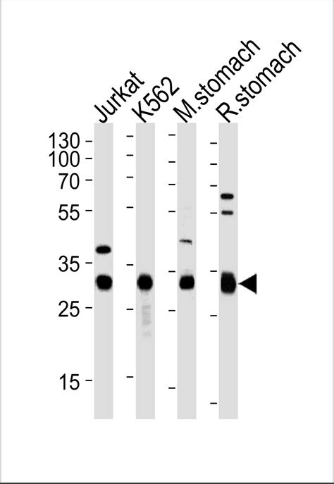 ESD Antibody (Center) - Purified Rabbit Polyclonal Antibody (Pab) WB, E ...