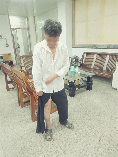 广东一残疾男子遭妻子家暴被打伤，半年前曾获人身保护令