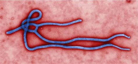 对埃博拉病毒进行显微镜研究图片-科学家在血液样本中对埃博拉病毒进行显微镜研究素材-高清图片-摄影照片-寻图免费打包下载