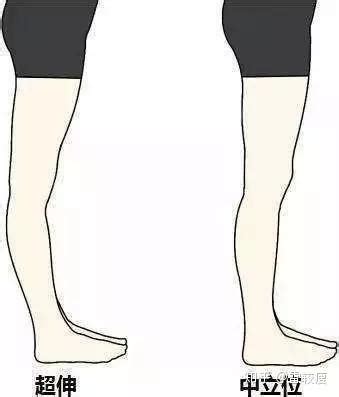 膝盖疼的原因和正确改善姿势 - 知乎
