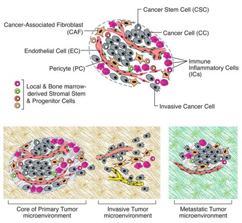 肿瘤疾病发展的五个阶段胃癌插画图片下载-正版图片402359686-摄图网