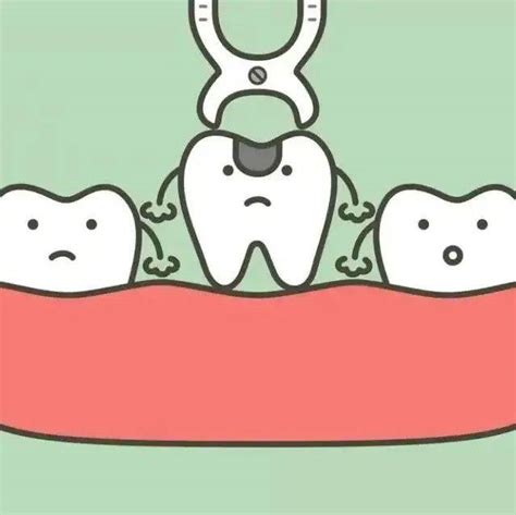 @准备拔牙的你，先了解清楚拔牙有哪些禁忌症？_治疗_患者_口腔