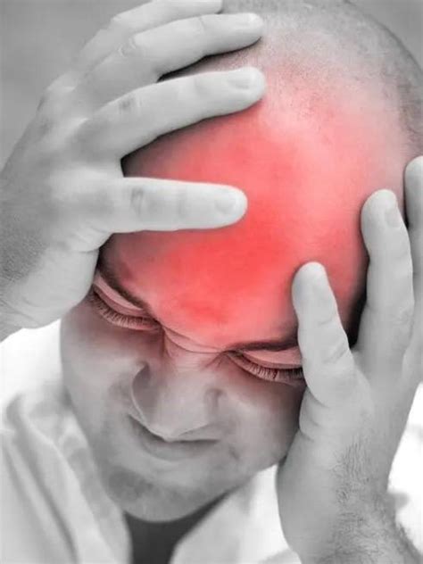 头痛是最常见的神经系统疾病之一 - 微医（挂号网）