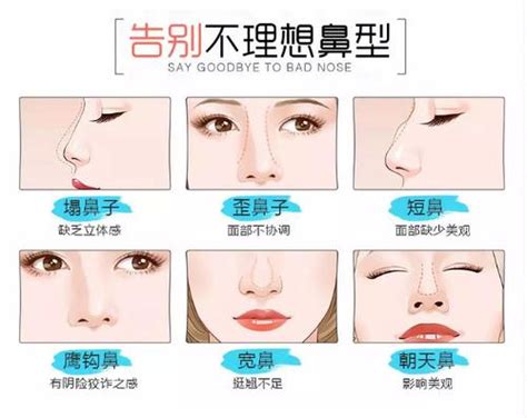 【图】鼻型分类图片 六种不同鼻子形状你属于哪一种？_鼻型分类图_伊秀美容网|yxlady.com