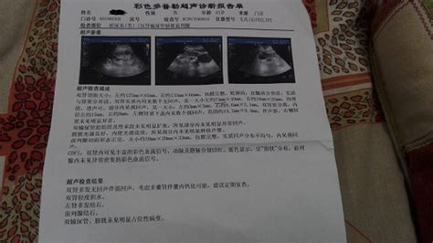 请专家们帮我看看四维彩超报告单：年龄 24岁怀孕25周 - 百度宝宝知道