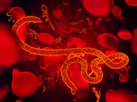 埃博拉病信息集感染症状分布图矢量图插画图片下载-正版图片300935007-摄图网
