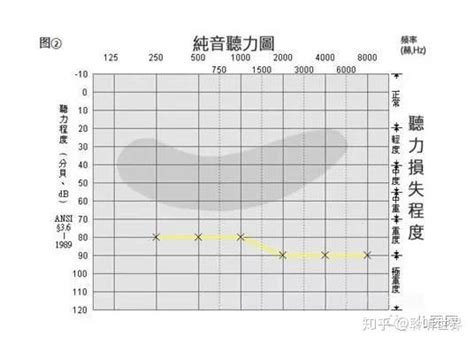 电测听力计——MADSEN兹达(Xeta)听力计-荟翊医疗科技（上海）有限公司