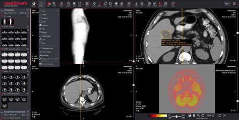DICOM可视化软件 - MedDream WEB DICOM - SOFTNETA Medical Imaging - 诊断 / PACS ...