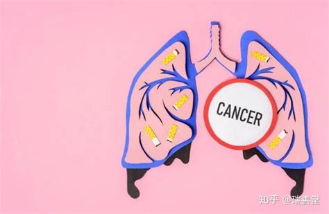 “作恶多端”的小细胞肺癌，一发现就是晚期，如何判断早期信号？ - 知乎