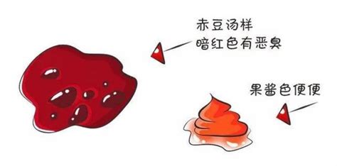 果酱样大便图片