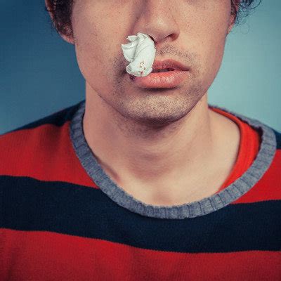 鼻子出血是什么病征兆?_39健康经验