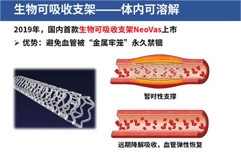 2019年全球可降解塑料行业政策、产量及在建产能分析：可降解塑料未来成长空间10倍以上[图]_智研咨询