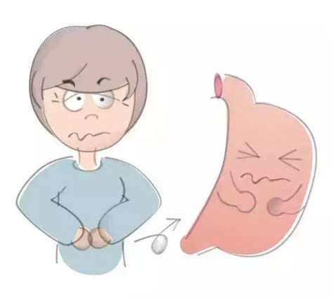 胃反酸是怎么回事怎样治疗（经常做这4件事，难怪胃会反酸、烧心，3件事能帮您缓解） | 说明书网