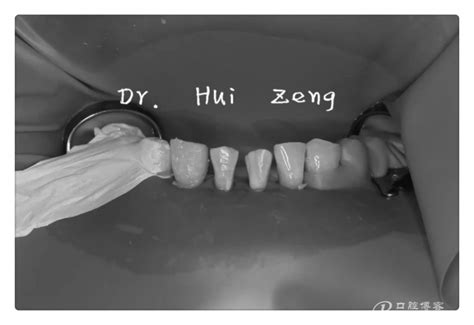 常州钟楼区口腔医院价格一览表,含常州美奥/北极星种牙价格,牙齿对比照片-8682赴韩整形网